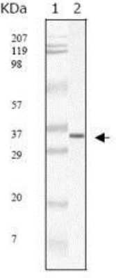 Western Blot: Sars Membrane Protein Antibody (2H2C4)Azide and BSA Free [NBP1-28852]