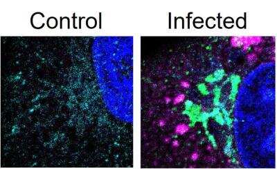 Immunocytochemistry/ Immunofluorescence: Sars Membrane Protein Antibody [NB100-56569]