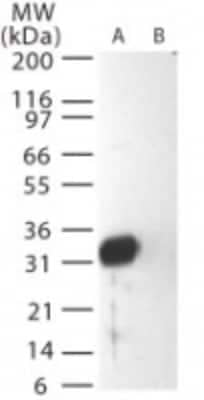 Western Blot: Sars Membrane Protein Antibody [NB100-56569]