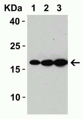 Western Blot: Sars Membrane Protein AntibodyBSA Free [NBP2-41060]