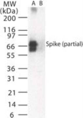 Western Blot: SARS Spike Protein Antibody [NB100-56047]