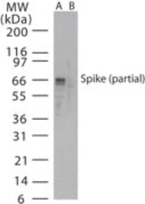 Western Blot: SARS Spike Protein Antibody [NB100-56048]