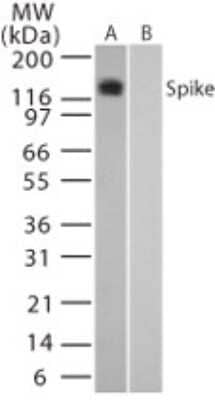 Detection of SARS Spike Protein in Transfected and Untransfected Mouse Melanoma Cell Lysate by Western Blot
