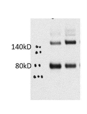 Western Blot Detection of SARS-CoV-2 Spike in 293T Cell Lysate Using SARS Spike Protein Antibody