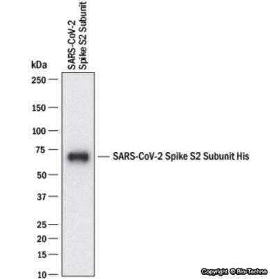Western Blot Detection of Recombinant SARS-CoV-2 Spike S2 Subunit Using SARS Spike Protein Antibody