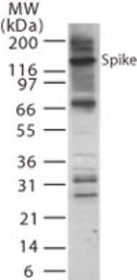 Western Blot: SARS Spike Protein Antibody [NB100-56589]