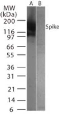 Western Blot: SARS Spike Protein Antibody [NB100-56684]