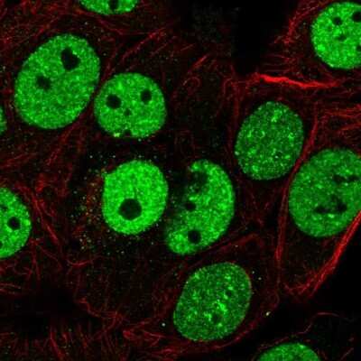 Immunocytochemistry/ Immunofluorescence: Scaffold attachment factor B2 Antibody [NBP2-13274]