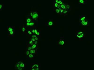 Immunocytochemistry/ Immunofluorescence: Scaffold attachment factor B2 Antibody [NBP2-98007]