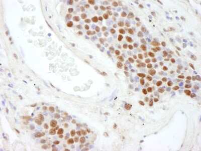 Immunohistochemistry: Scaffold attachment factor B2 Antibody [NB100-58791]