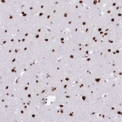 Immunohistochemistry-Paraffin: Scaffold attachment factor B2 Antibody [NBP2-13274]