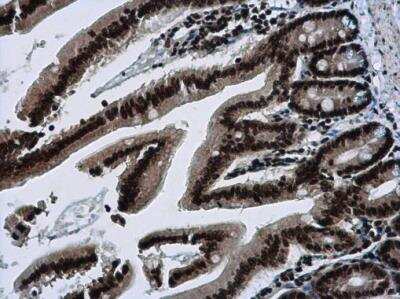 Immunohistochemistry-Paraffin: Scaffold attachment factor B2 Antibody [NBP2-20265]