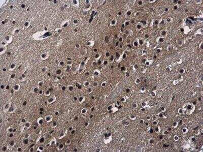 Immunohistochemistry-Paraffin: Scaffold attachment factor B2 Antibody [NBP2-20265]