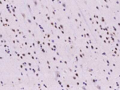 Immunohistochemistry-Paraffin: Scaffold attachment factor B2 Antibody [NBP2-98007]