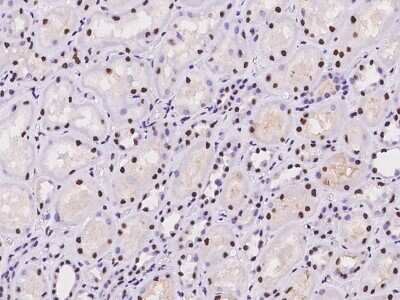 Immunohistochemistry-Paraffin: Scaffold attachment factor B2 Antibody [NBP2-98007]