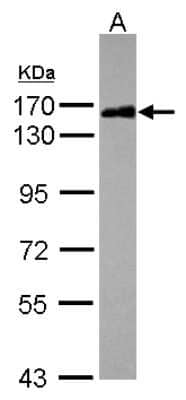 Western Blot: Scaffold attachment factor B2 Antibody [NBP2-20265]