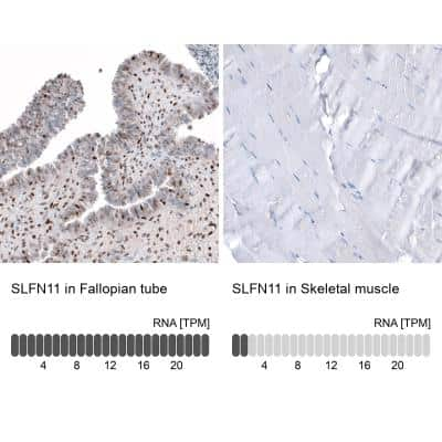 Immunohistochemistry-Paraffin: Schlafen 11 Antibody [NBP1-92368]