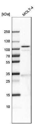 Western Blot: Schlafen 11 Antibody [NBP1-92368]