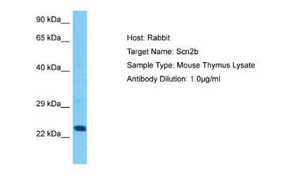 Western Blot: Scn2b Antibody [NBP2-82340]