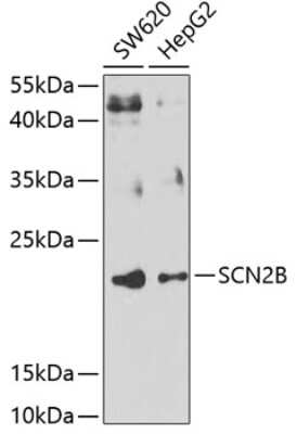 Western Blot: Scn2b AntibodyBSA Free [NBP2-93470]