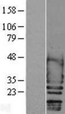 Western Blot: Scn2b Overexpression Lysate [NBL1-15742]