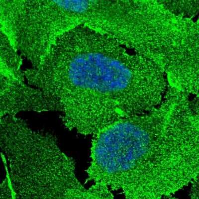 Immunocytochemistry/ Immunofluorescence: Scribble Antibody [NBP2-47286]