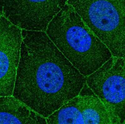 Immunocytochemistry/ Immunofluorescence: Scribble Antibody [NBP2-56134]