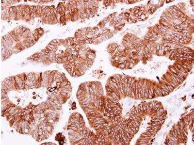 Immunohistochemistry-Paraffin: Scribble Antibody [NBP2-15110]