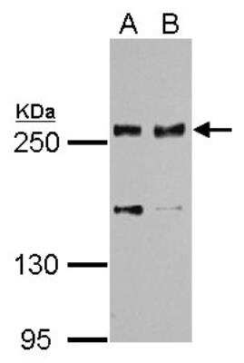 Western Blot: Scribble Antibody [NBP2-15110]
