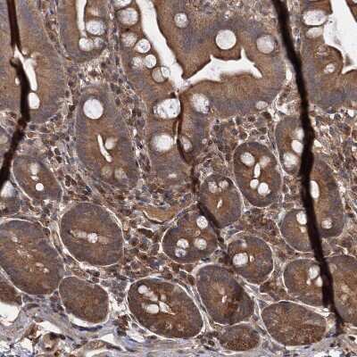 Immunohistochemistry-Paraffin: SeP Antibody [NBP1-80766]