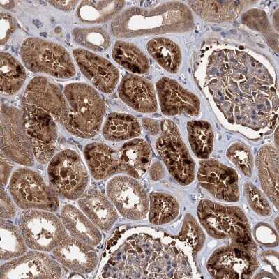 Immunohistochemistry-Paraffin: SeP Antibody [NBP1-80766]