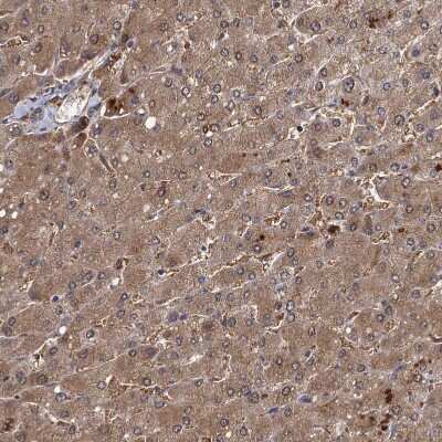 Immunohistochemistry-Paraffin: SeP Antibody [NBP1-80766]