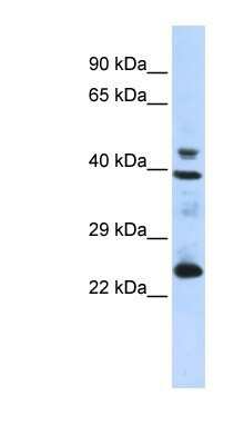 Western Blot: SeP Antibody [NBP1-70770]