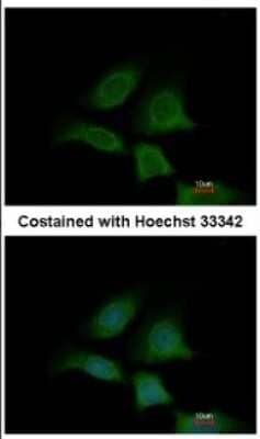 Immunocytochemistry/ Immunofluorescence: Sec8 Antibody [NBP2-20283]