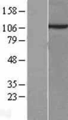 Western Blot: Sec8 Overexpression Lysate [NBL1-10379]