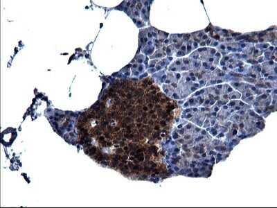 Immunohistochemistry: Secernin-1 Antibody (OTI1F2) [NBP2-45727]