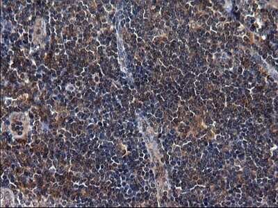 Immunohistochemistry: Secernin-1 Antibody (OTI1F2) [NBP2-45727]