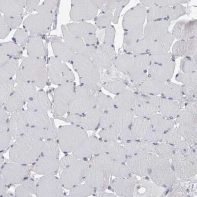 Immunohistochemistry-Paraffin: Secernin-1 Antibody [NBP1-87861]