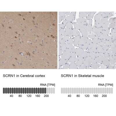 Immunohistochemistry-Paraffin: Secernin-1 Antibody [NBP1-87861]