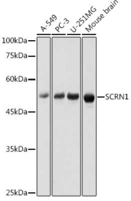 Western Blot: Secernin-1 AntibodyAzide and BSA Free [NBP3-16020]