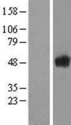 Western Blot: Secernin-1 Overexpression Lysate [NBL1-15751]