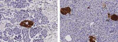 Immunohistochemistry-Paraffin: Secretagogin Antibody (048) [NBP2-90100]