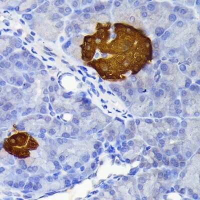 Immunohistochemistry-Paraffin: Secretagogin Antibody (9K8H9) [NBP3-15814]