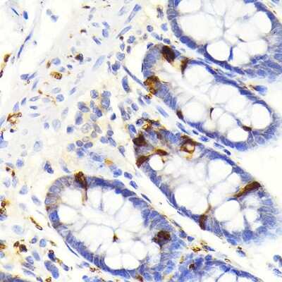 Immunohistochemistry-Paraffin: Secretagogin Antibody (9K8H9) [NBP3-15814]