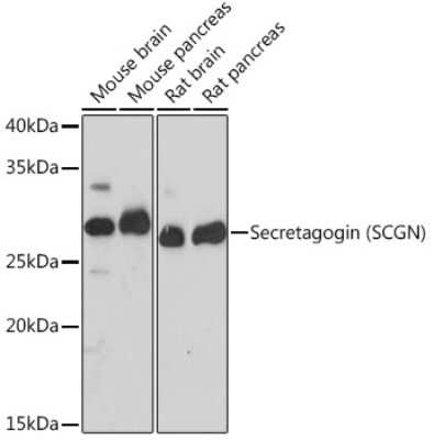 Western Blot: Secretagogin Antibody (9K8H9) [NBP3-15814]