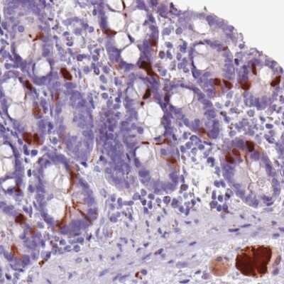 Immunohistochemistry: Secretagogin Antibody (CL0271) [NBP2-52897]