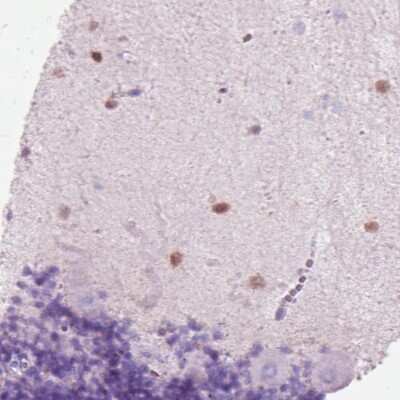 Immunohistochemistry-Paraffin: Secretagogin Antibody (CL0271) [NBP2-52897]