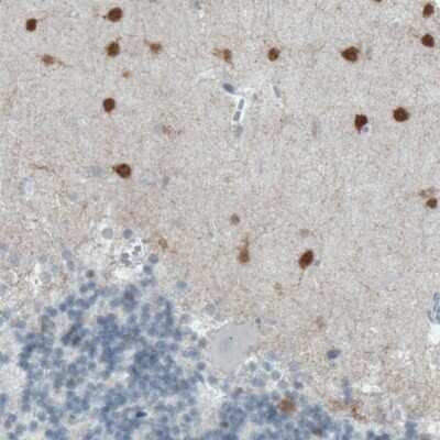 Immunohistochemistry-Paraffin: Secretagogin Antibody (CL0273) [NBP2-52898]