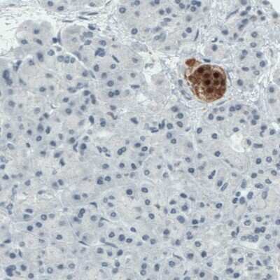 Immunohistochemistry-Paraffin: Secretagogin Antibody (CL0273) [NBP2-52898]