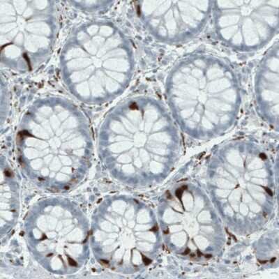 Immunohistochemistry-Paraffin: Secretagogin Antibody (CL0273) [NBP2-52898]